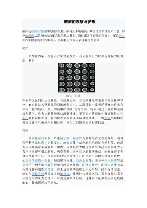 脑疝的观察与护理