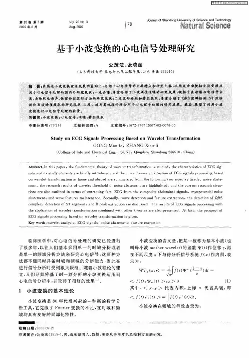 基于小波变换的心电信号处理研究