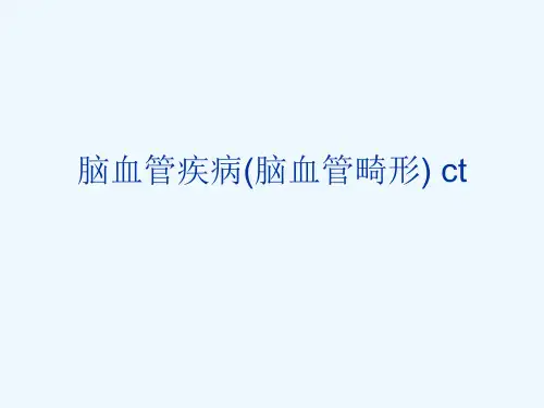 脑血管疾病(脑血管畸形) ct[可修改版ppt]