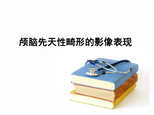 医学影像-颅脑先天性畸形的影像表现