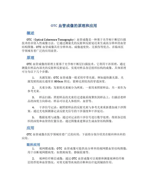 otc血管成像的原理和应用