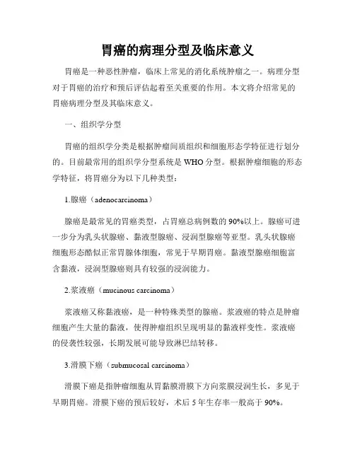 胃癌的病理分型及临床意义