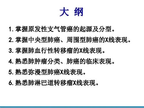影像诊断学5-肺肿瘤 -图片课件