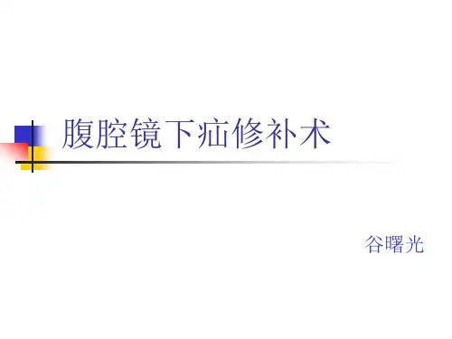 腹腔镜疝修补术详解