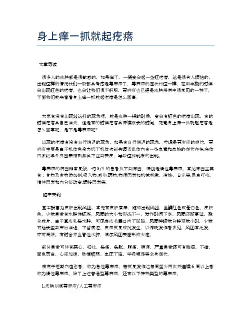 身上痒一抓就起疙瘩【医学养生常识】