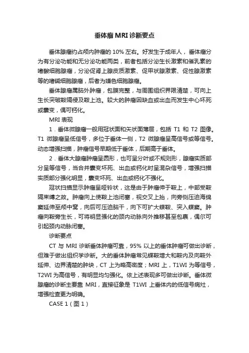 垂体瘤MRI诊断要点