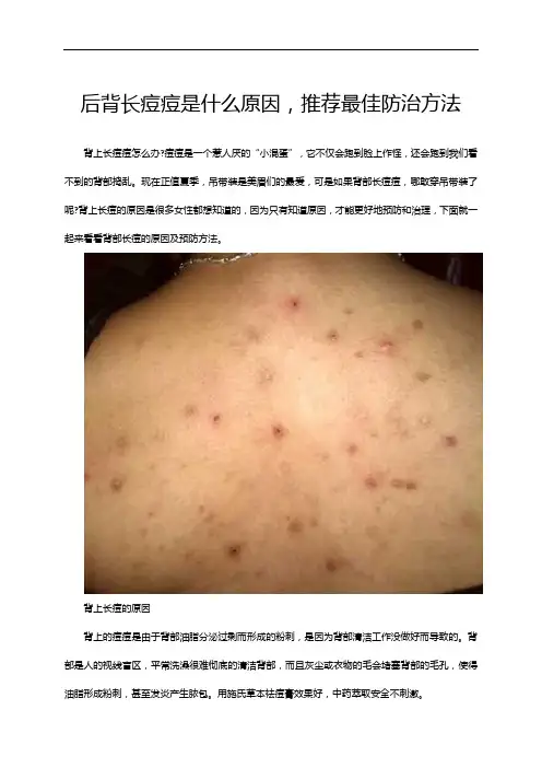 后背长痘痘是什么原因,最佳防治方法