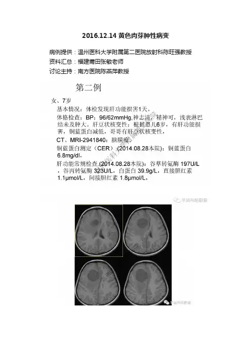 2016.12.14黄色肉芽肿性病变