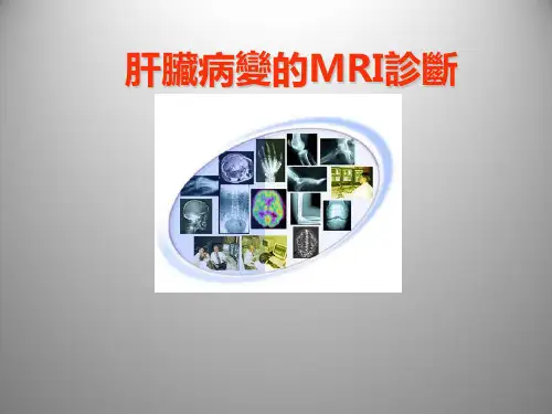 肝脏病变的MRI诊断  PPT课件