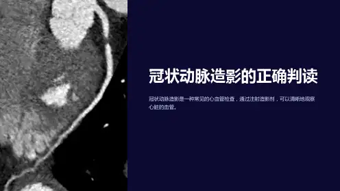 冠状动脉造影的正确判读