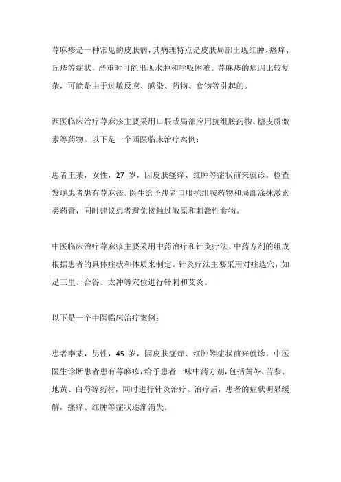 荨麻疹中西医临床治疗案例