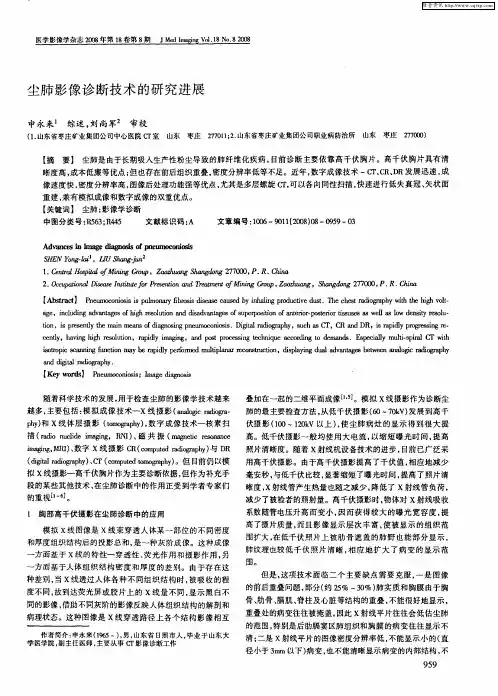 尘肺影像诊断技术的研究进展