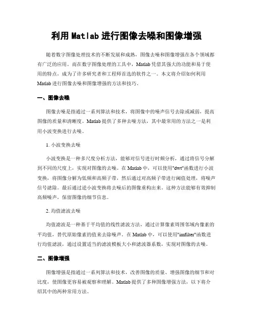 利用Matlab进行图像去噪和图像增强