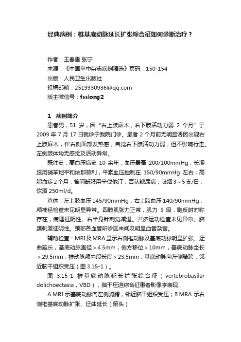 经典病例：椎基底动脉延长扩张综合征如何诊断治疗？