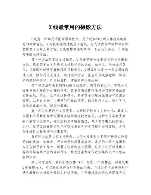 X线最常用的摄影方法