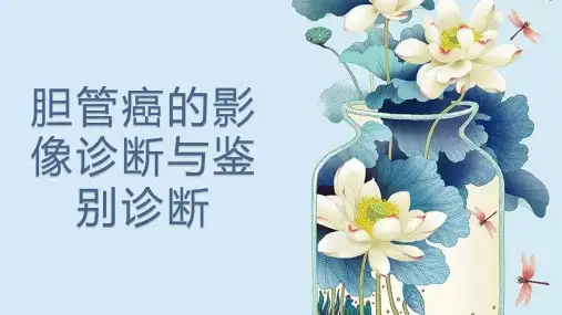 胆管癌的影像诊断与鉴别诊断
