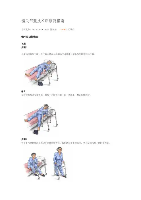 髋关节置换术后康复指南