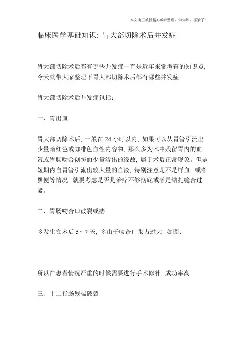 临床医学基础知识：胃大部切除术后并发症