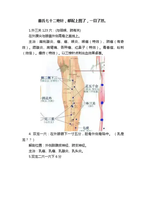 董氏七十二绝针，都配上图了，一目了然。