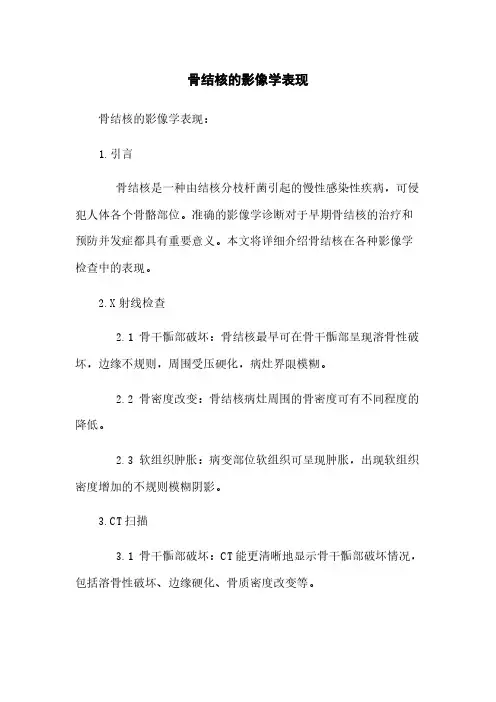 骨结核的影像学表现