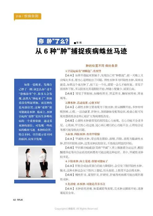 从6_种“肿”捕捉疾病蛛丝马迹