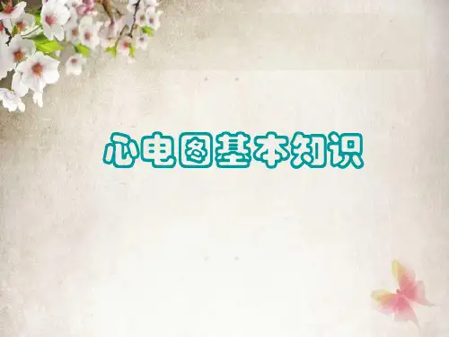 ICU常见心电图分析