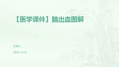 【医学课件】脑出血图解
