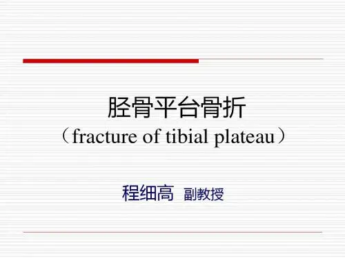 胫骨平台骨折fractureoftibialplateau