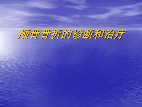 颅骨骨折