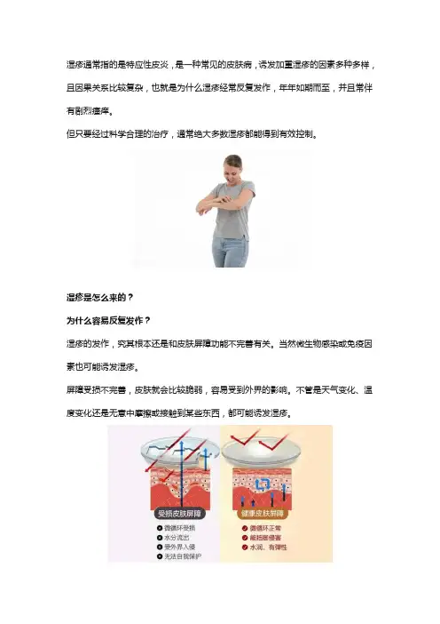 皮炎湿疹反复发作怎么办？