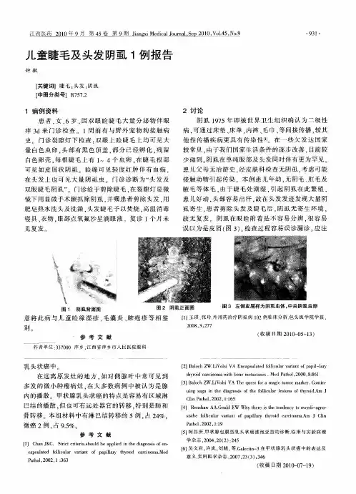 儿童睫毛及头发阴虱1例报告