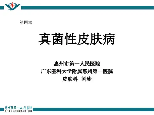 刘珍  PPT  课件 真菌性皮肤病