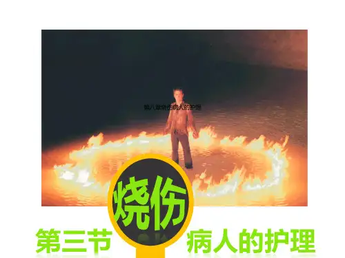 第八章烧伤病人的护理.pptx