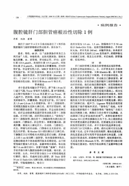 腹腔镜肝门部胆管癌根治性切除1例
