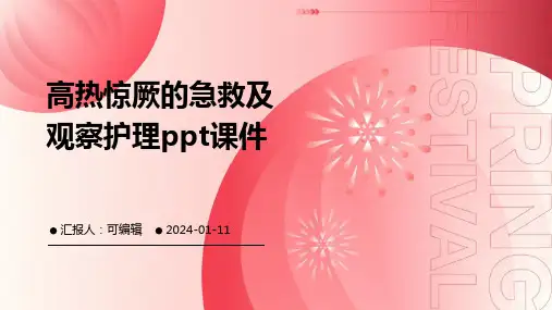 高热惊厥的急救及观察护理PPT课件