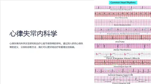 心律失常内科学