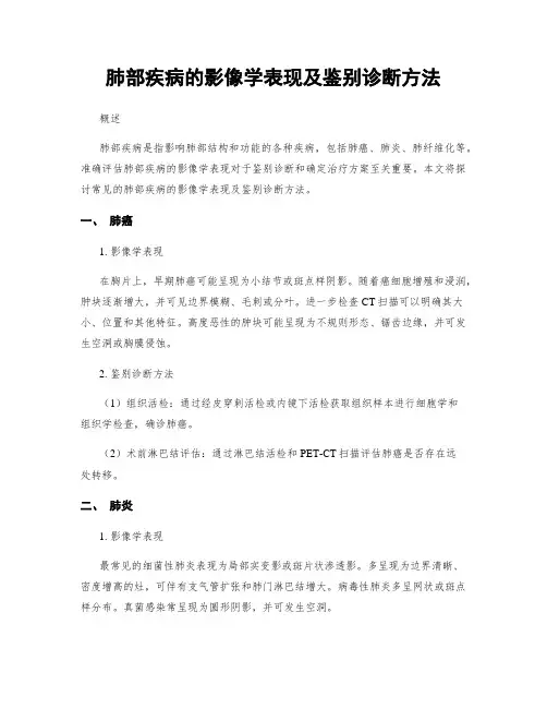 肺部疾病的影像学表现及鉴别诊断方法