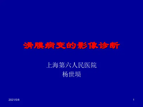 滑膜病变的影像诊断