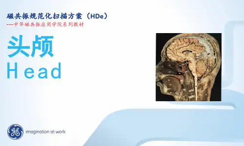 MRI头部规范化规范化扫描方案
