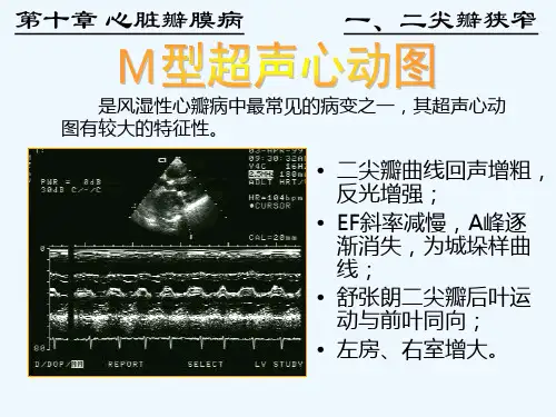 心脏彩超诊断ppt课件