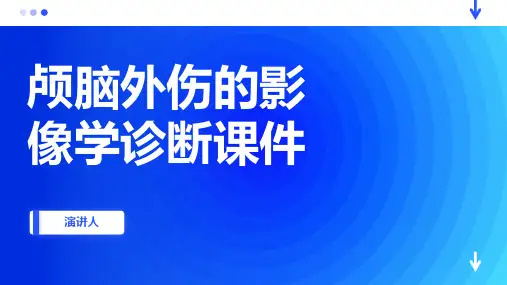 颅脑外伤的影像学诊断课件