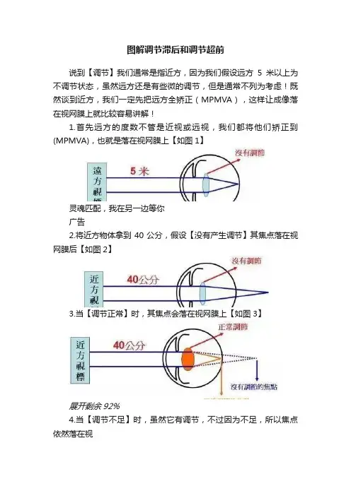 图解调节滞后和调节超前