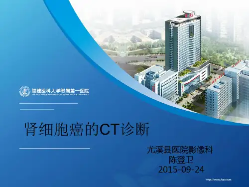 肾细胞癌的ct诊断演示课件
