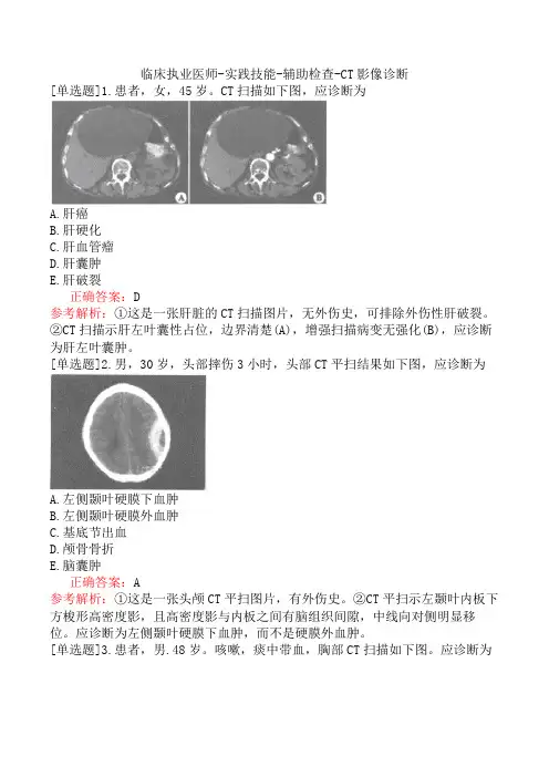 临床执业医师-实践技能-辅助检查-CT影像诊断