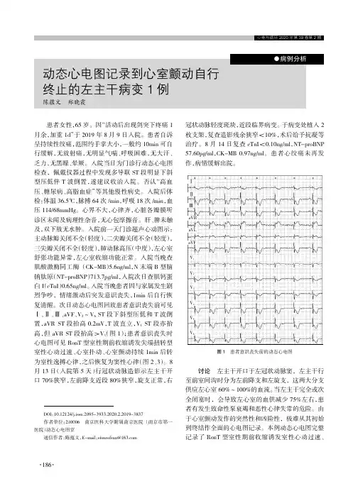 动态心电图记录到心室颤动自行终止的左主干病变1例