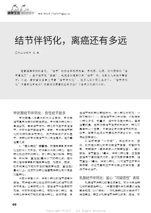 结节伴钙化，离癌还有多远