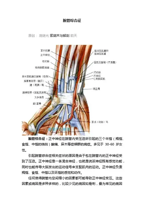 腕管综合征