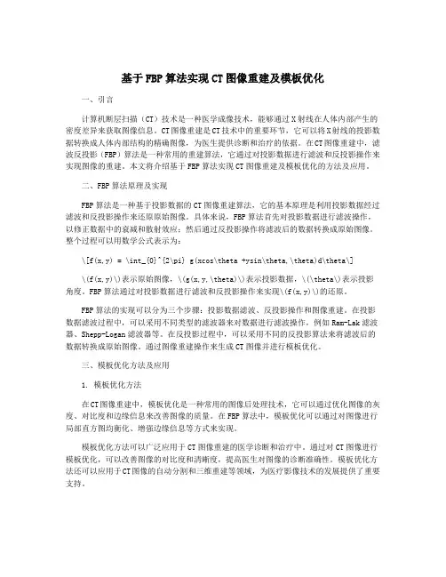 基于FBP算法实现CT图像重建及模板优化