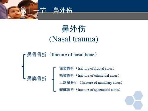 临床医学-耳鼻喉科-鼻外伤