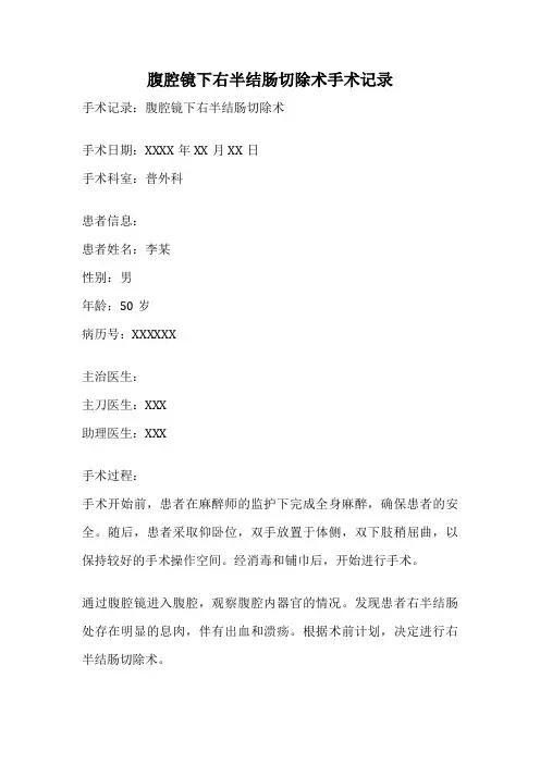 腹腔镜下右半结肠切除术手术记录